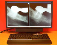 nm endo xray